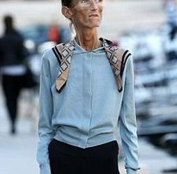 Skinniest Person in the World