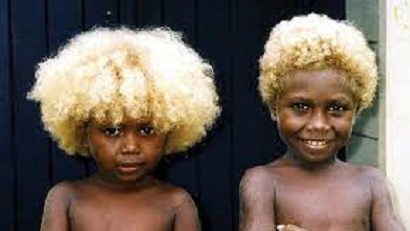 Melanesians the world’s only natural black on blondes people